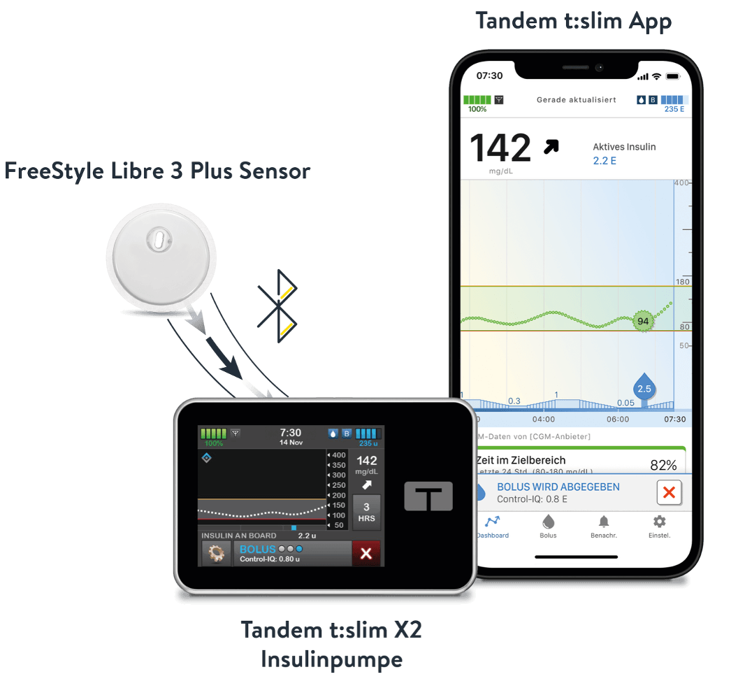 FreeStyle Libre 3 Plus Sensor, Tandem t:slim App und t:slim X2 Insulinpumpe