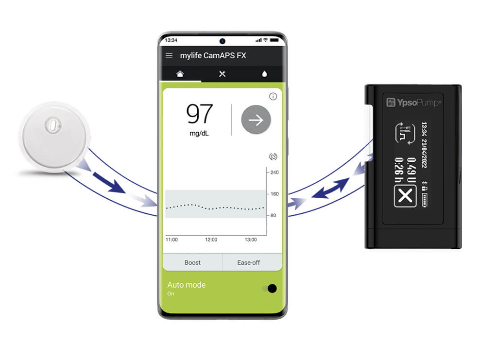 Schaubild FreeStyle Libre Sensor und das mylife Loop AID System verbunden über die FreeStyle Libre 3 App